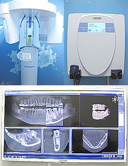 ドイツのシロナ社製 CT、パノラマとデンタルCCD CT 写真